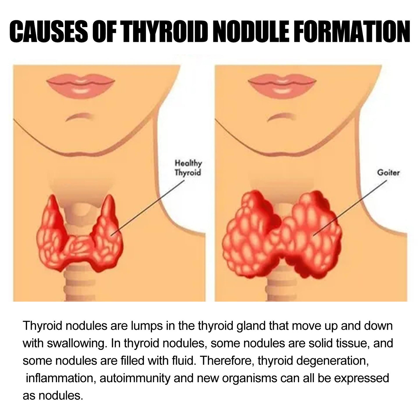 Thyroid & Lymphatic Health Care Sticker – Natural Relief Patch for Neck Wellness