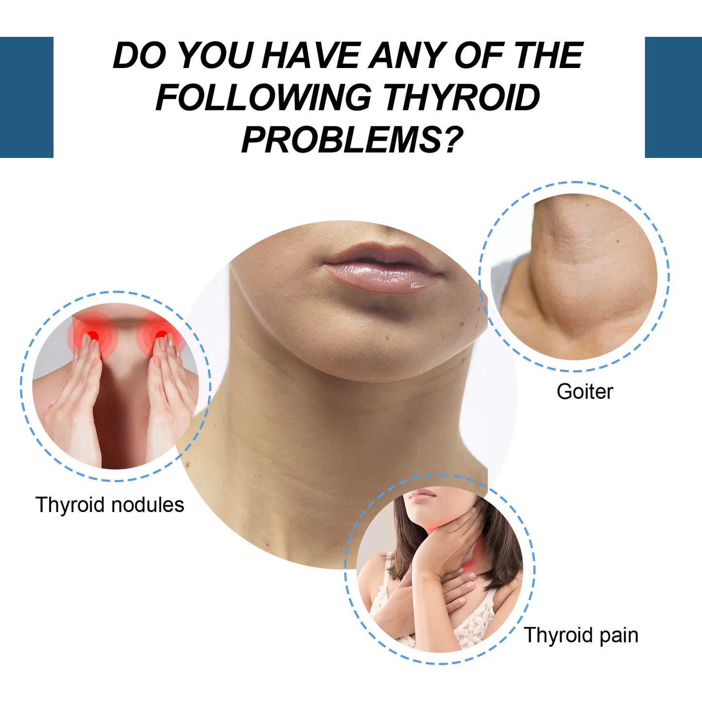 Thyroid & Lymphatic Health Care Sticker – Natural Relief Patch for Neck Wellness